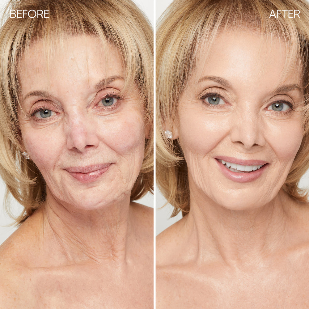 Before and after comparison of a woman's face