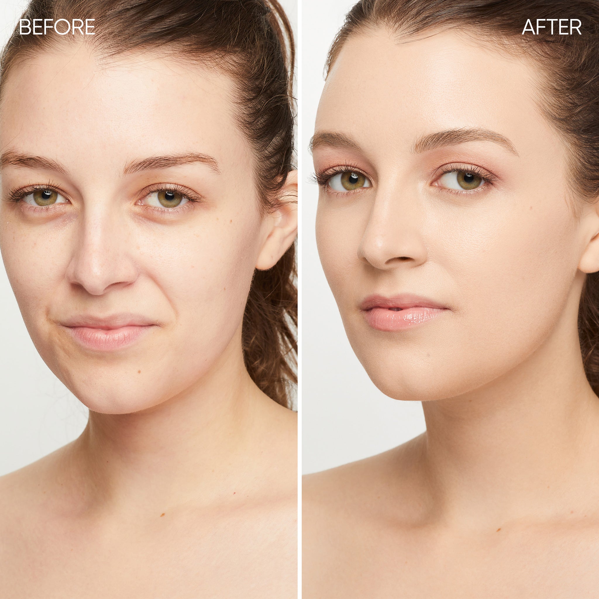 Before and after comparison of a woman's face 