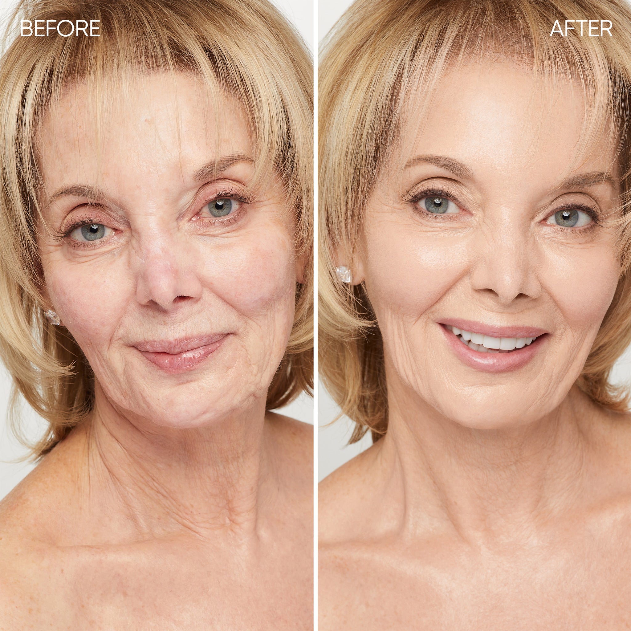 Before and after comparison of a woman's face 