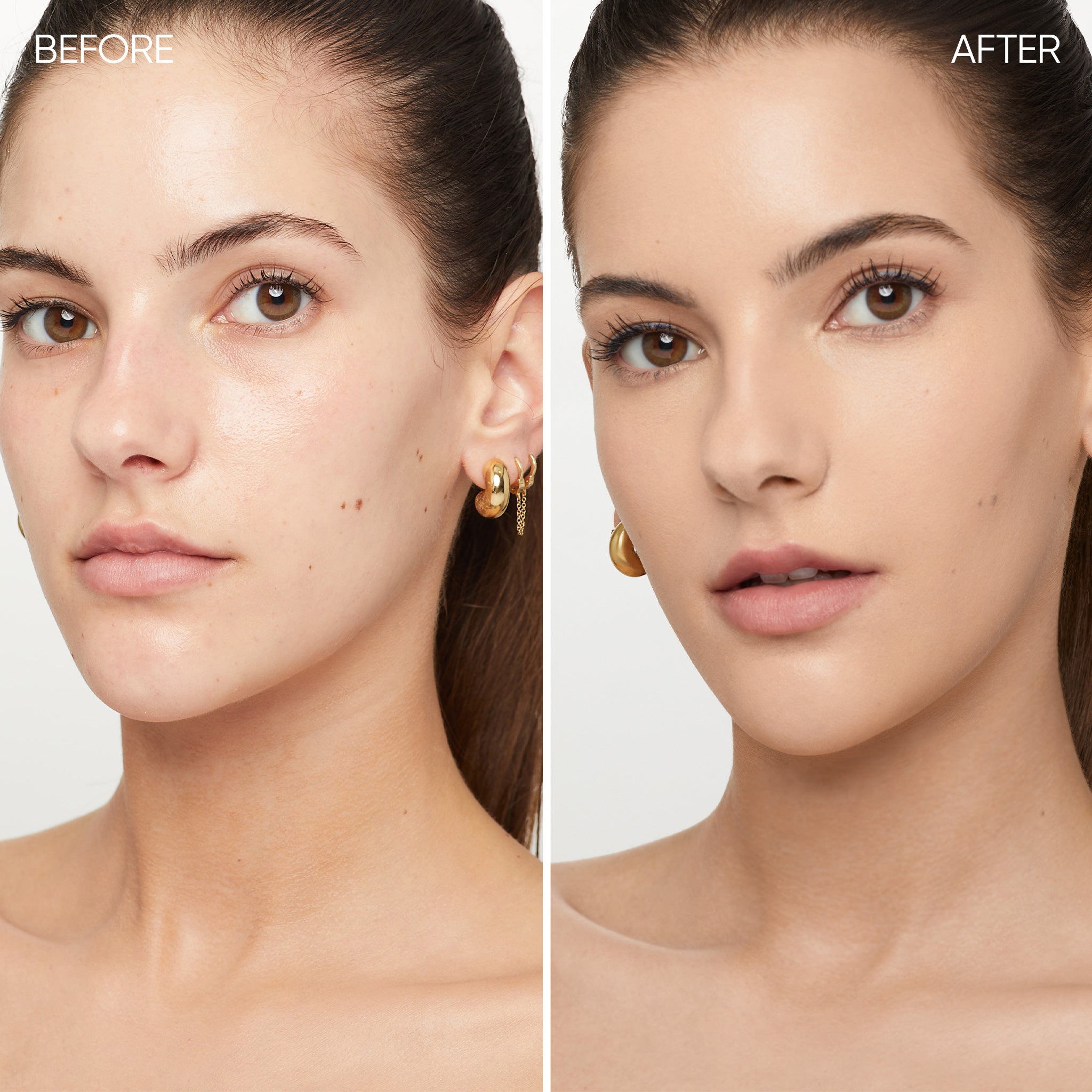 Before and after comparison of a woman's face
