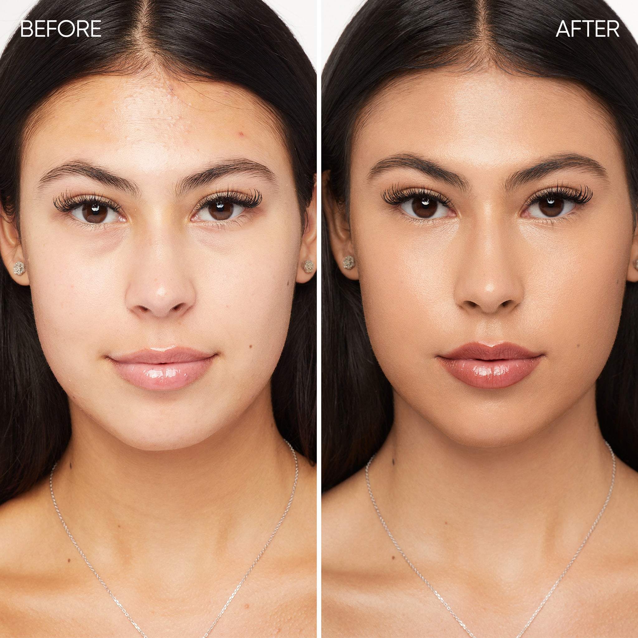 Before and after comparison of a woman's face
