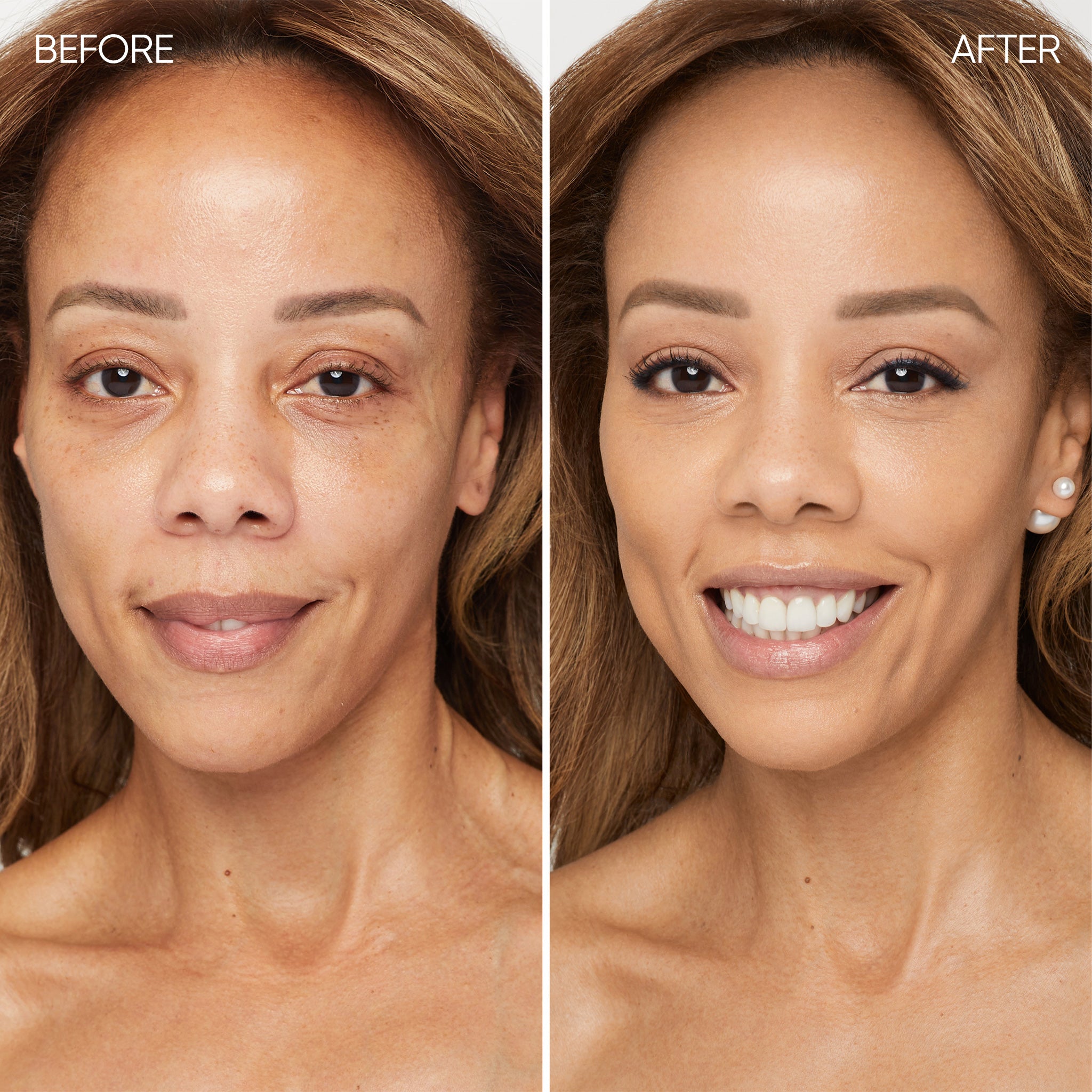 Before and after comparison of a woman's face