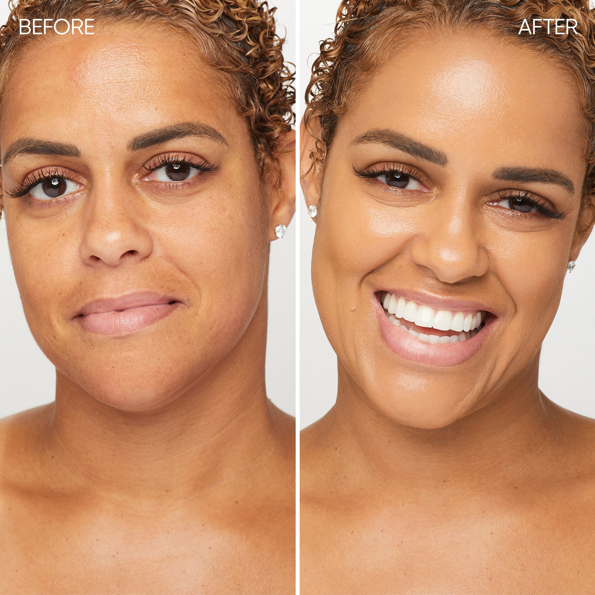 Before and after comparison of a woman's