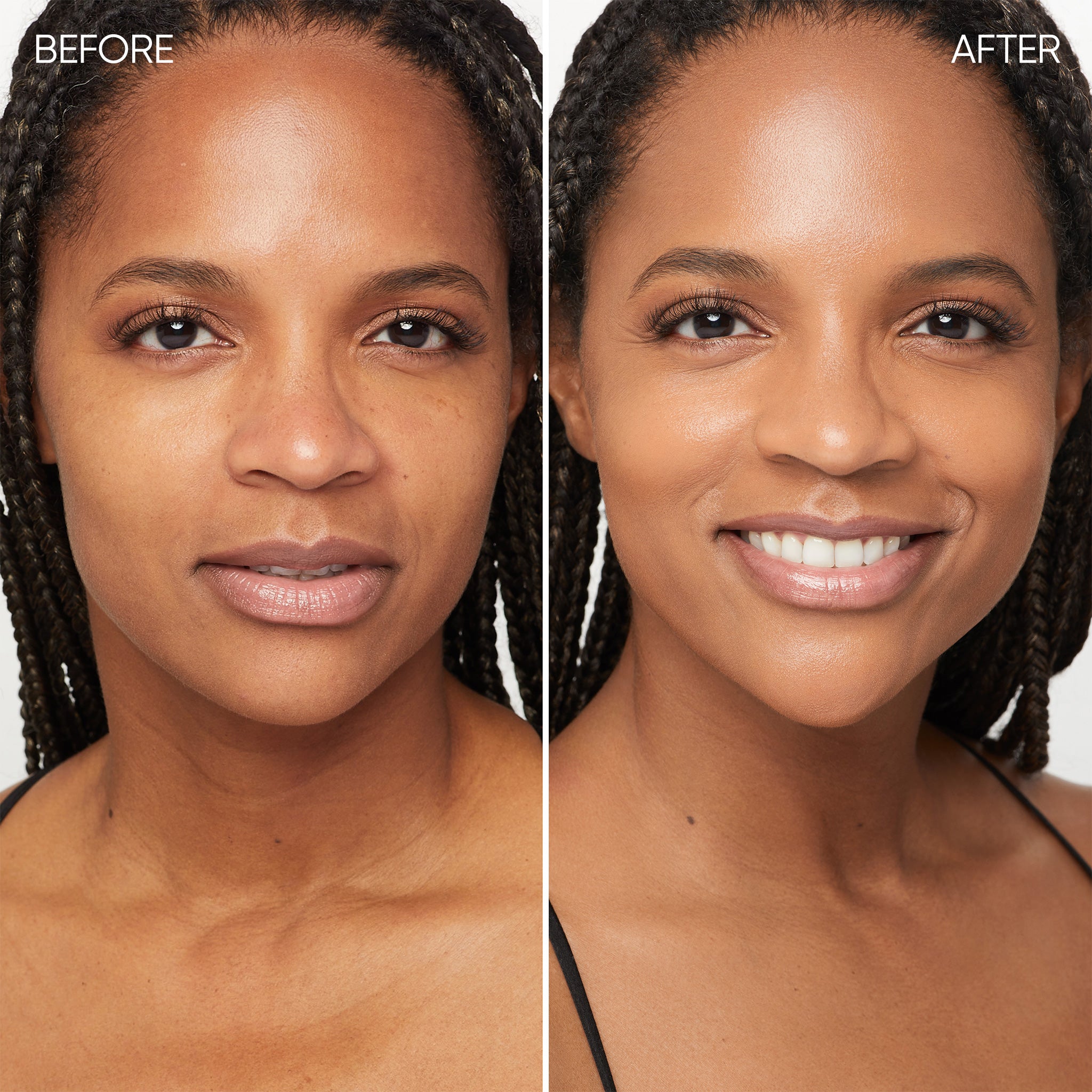 Before and after comparison of a woman's face