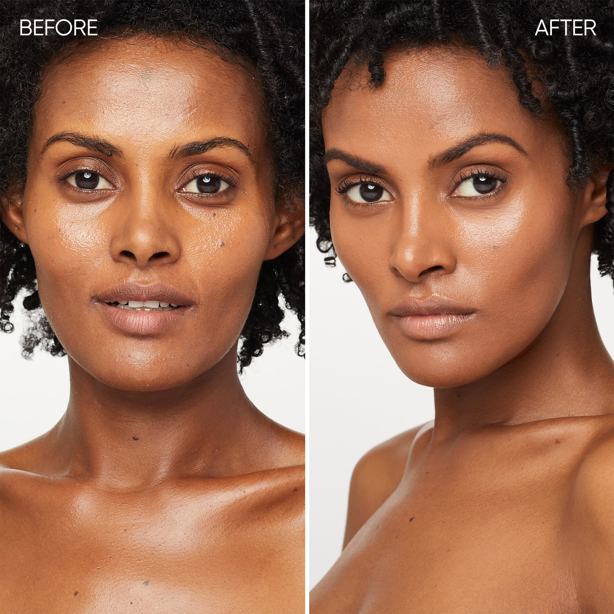 Before and after comparison of a woman's face with visible skin improvement.