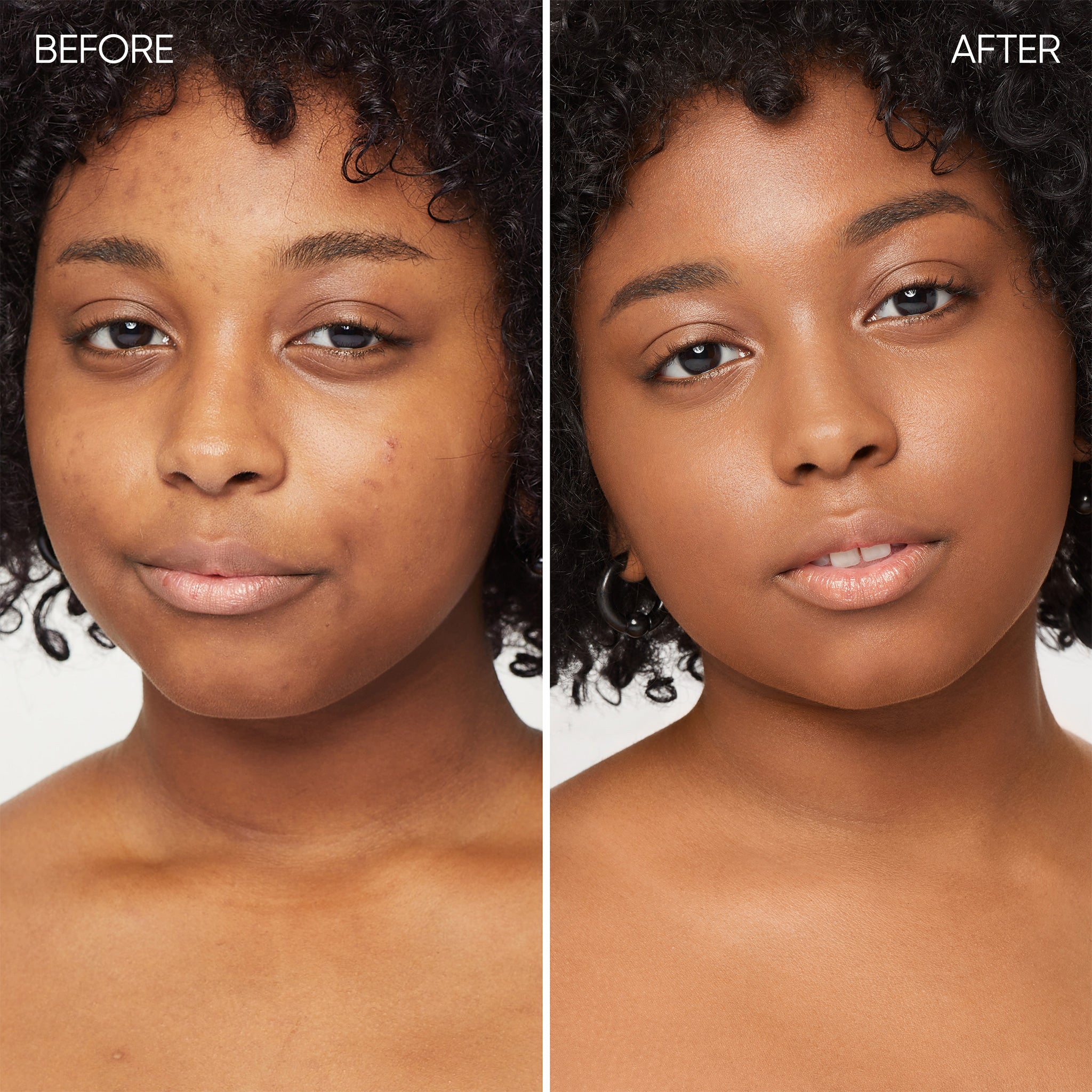 Before and after comparison of a person face