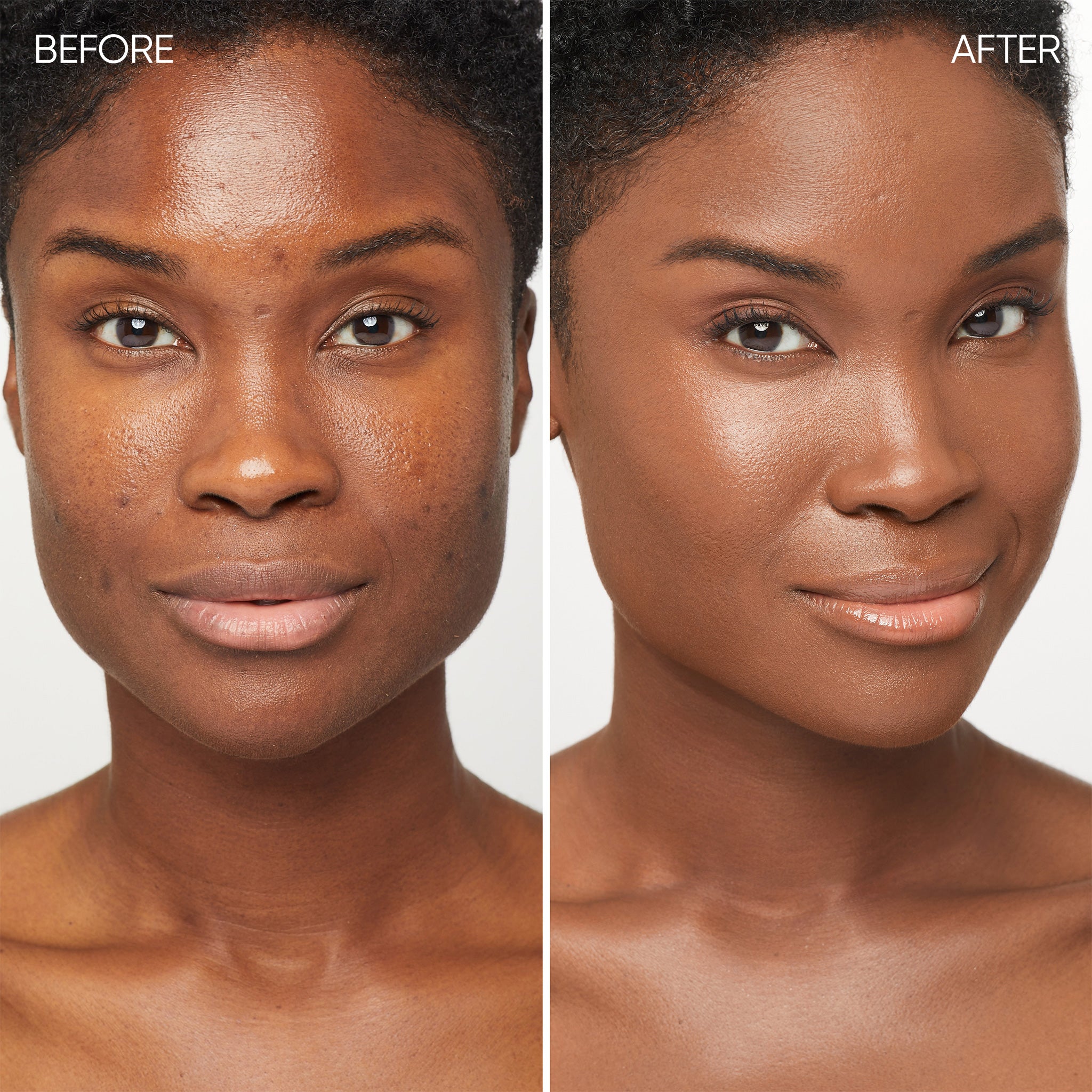 Before and after comparison of a woman's face