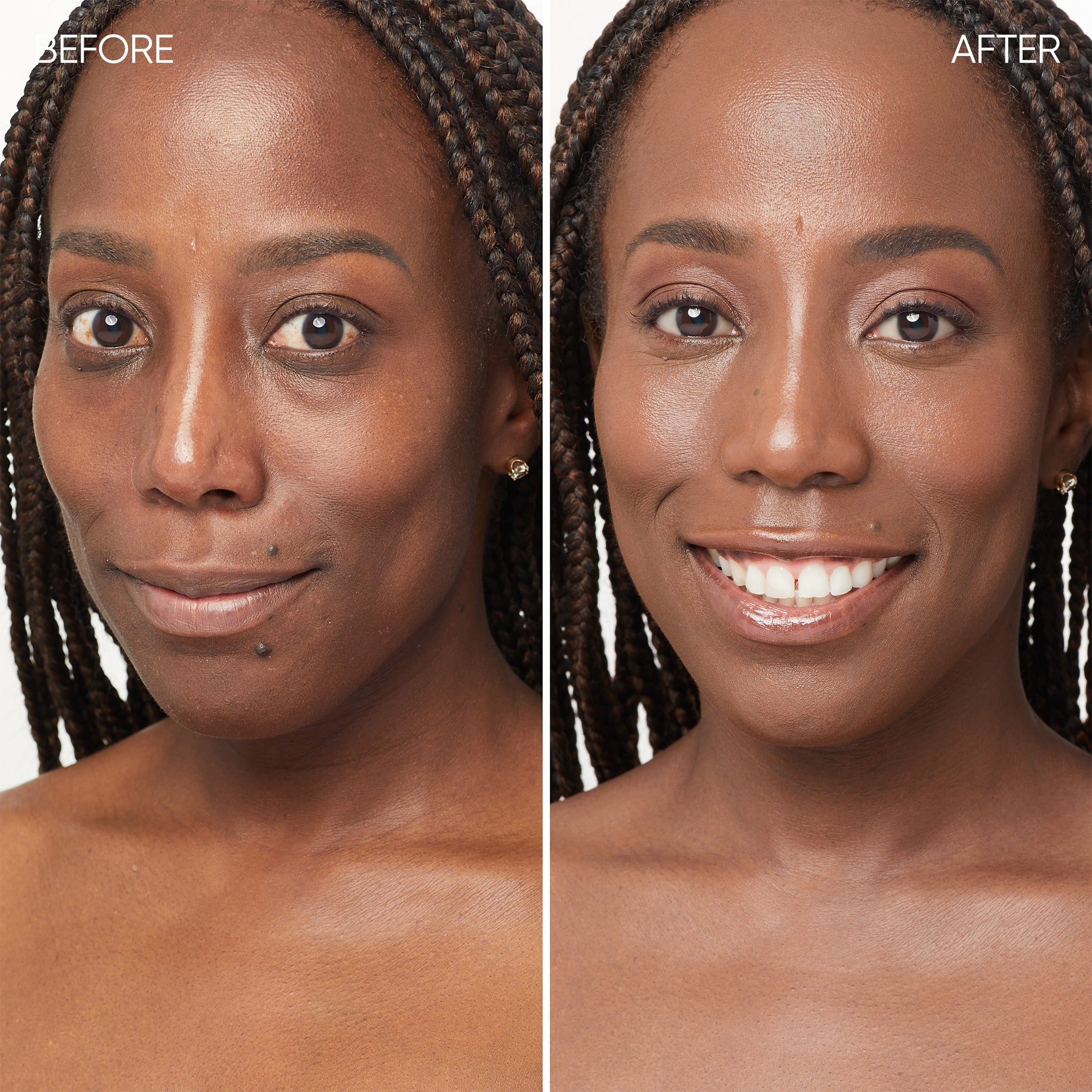 Before and after comparison of a woman's face with visible skin improvement.