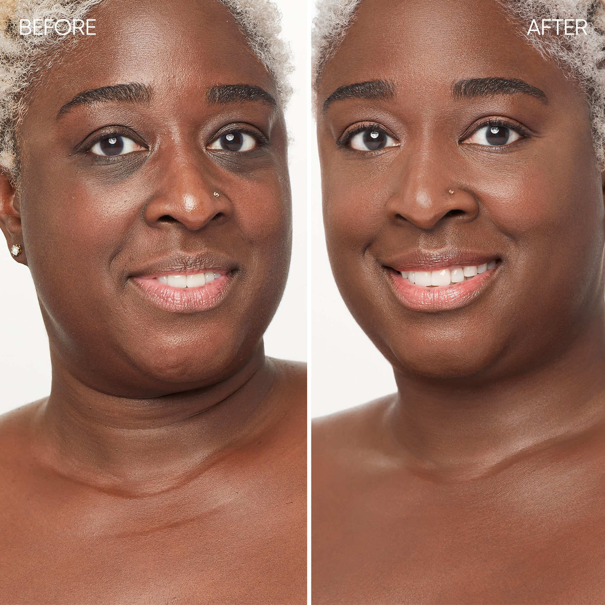 Before and after comparison of a woman's face