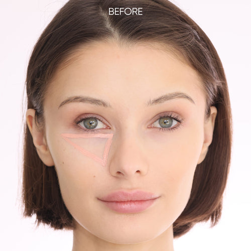 Close-up of a woman's face with 'BEFORE' text on a plain background