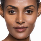Close-up of a woman's face with 'Before' text on a white background
