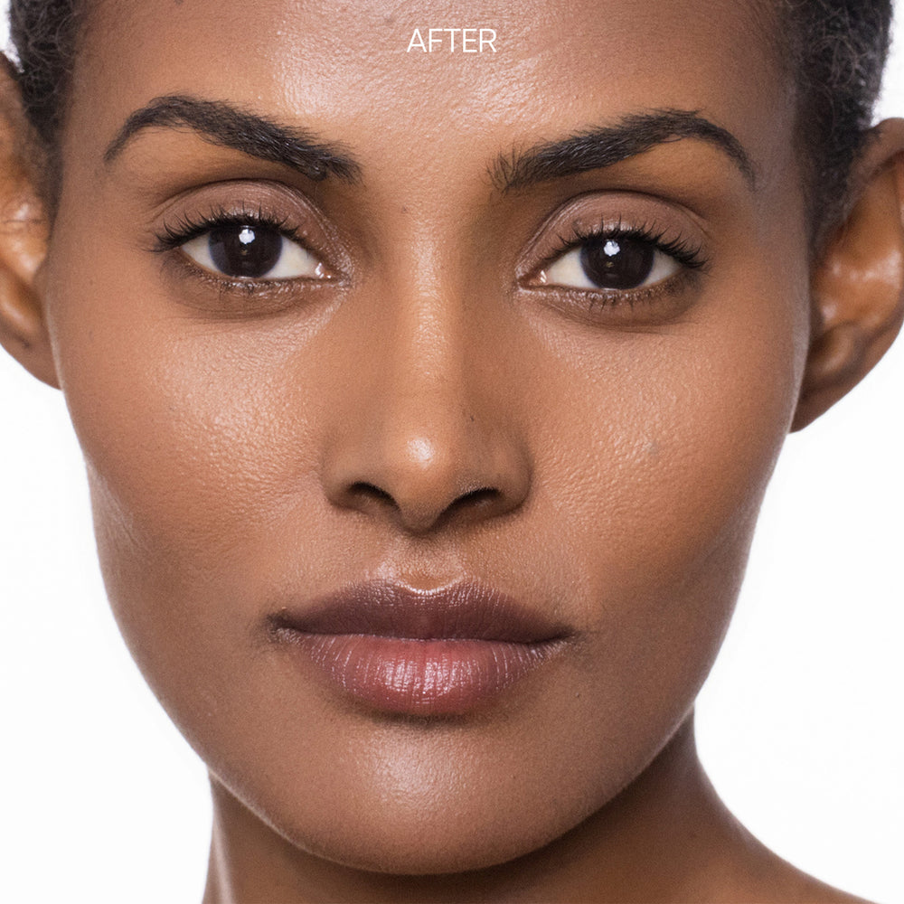 Close-up of a woman's face with 'AFTER' text, showing skin improvement.
